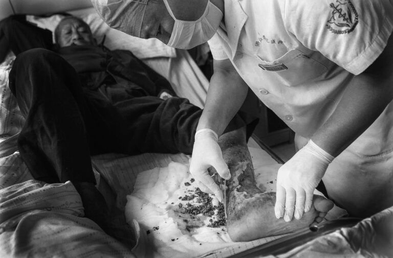 Han Qiang - 5、2015年9月21日，浙江衢化医院在为幸存受害者免费接受治疗清理创面。